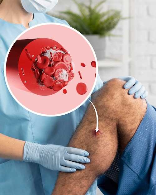Симптомы, диагностика и лечение асцита при циррозе печени